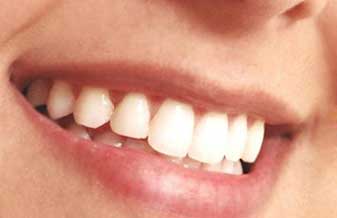 Reabilitar Odontologia - Foto 1